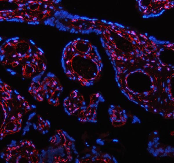 m00235 1 vimentin primary antibodies if testing 20_1