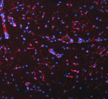 m00235 1 vimentin primary antibodies if testing 21