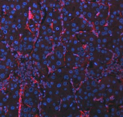 m00235 1 vimentin primary antibodies if testing 22