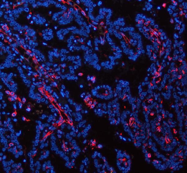 m00235 1 vimentin primary antibodies if testing 23