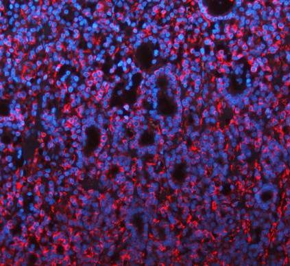 m00235 1 vimentin primary antibodies if testing 24
