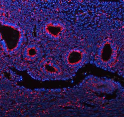 m00235 1 vimentin primary antibodies if testing 25