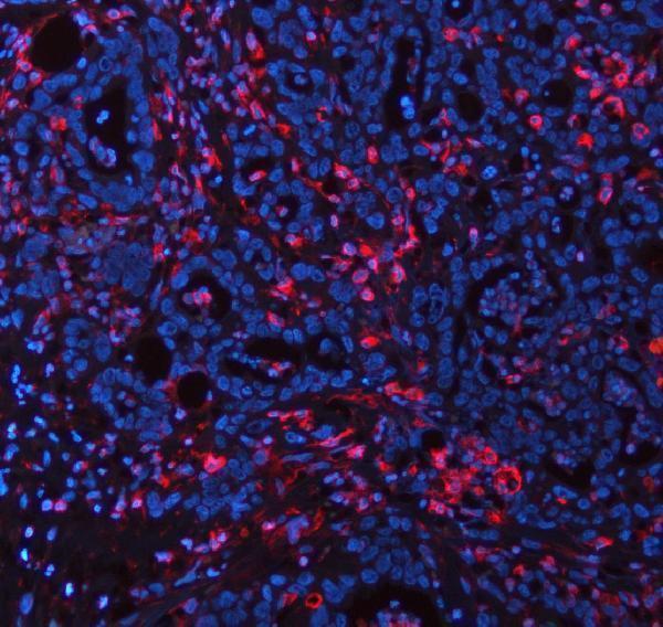 m00235 1 vimentin primary antibodies if testing 26