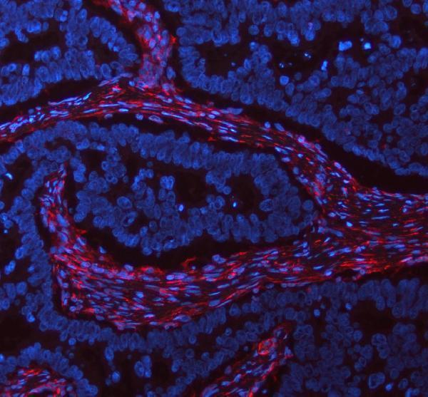 m00235 1 vimentin primary antibodies if testing 27