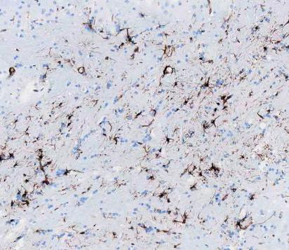 m00235 1 vimentin primary antibodies ihc testing 10