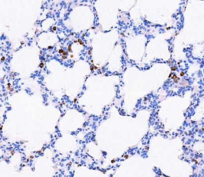 m00235 1 vimentin primary antibodies ihc testing 11