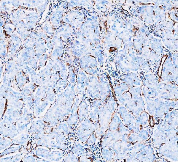 m00235 1 vimentin primary antibodies ihc testing 12