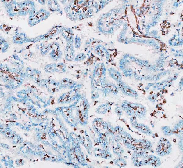 m00235 1 vimentin primary antibodies ihc testing 13