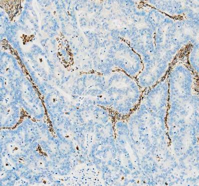 m00235 1 vimentin primary antibodies ihc testing 14