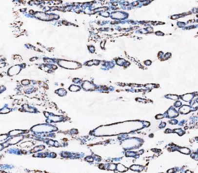 m00235 1 vimentin primary antibodies ihc testing 15