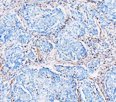m00235 1 vimentin primary antibodies ihc testing 16