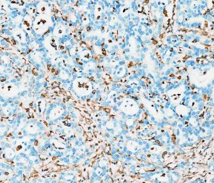 m00235 1 vimentin primary antibodies ihc testing 17
