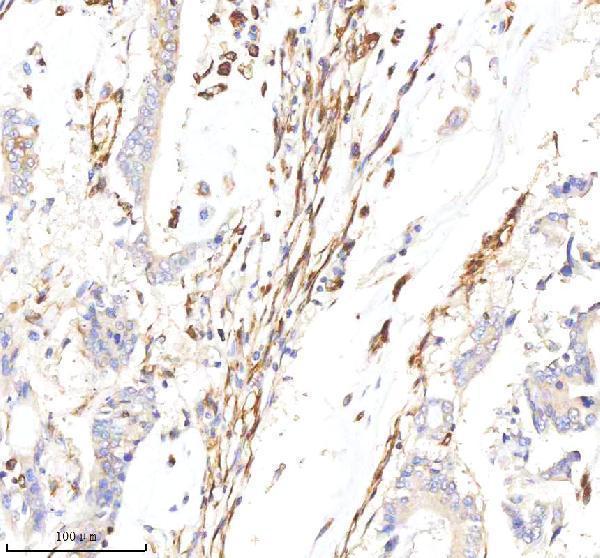  IHC analysis of Vimentin using anti-Vimentin antibody (M00235-1)