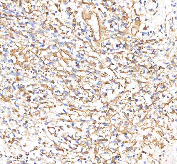 m00235 1 vimentin primary antibodies ihc testing 3