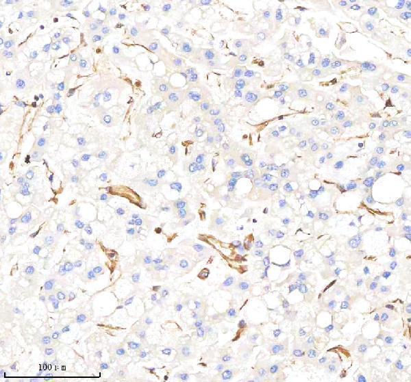 m00235 1 vimentin primary antibodies ihc testing 4