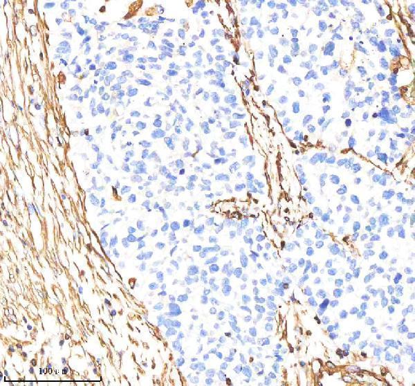 m00235 1 vimentin primary antibodies ihc testing 5