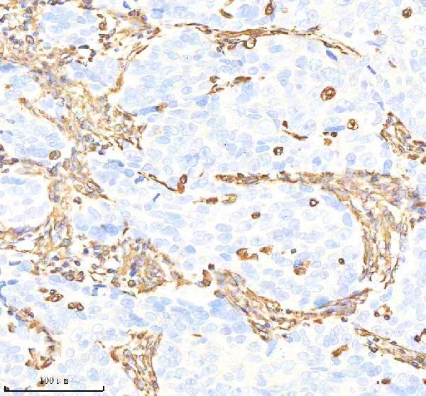 m00235 1 vimentin primary antibodies ihc testing 6