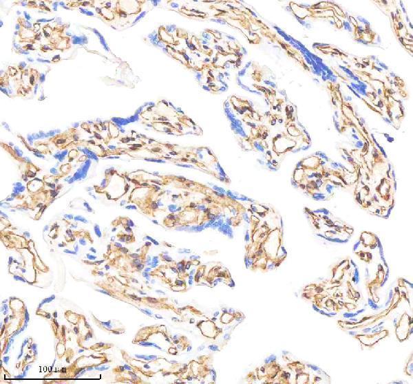 m00235 1 vimentin primary antibodies ihc testing 7