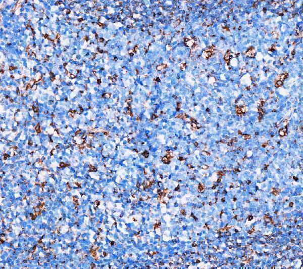 m00235 1 vimentin primary antibodies ihc testing 9
