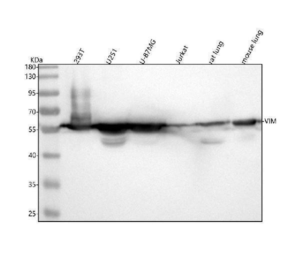  Western blot analysis of Vimentin using anti-Vimentin antibody (M00235-1)
