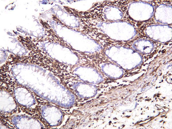 Human colon was stained with anti-Vimentin rabbit antibody