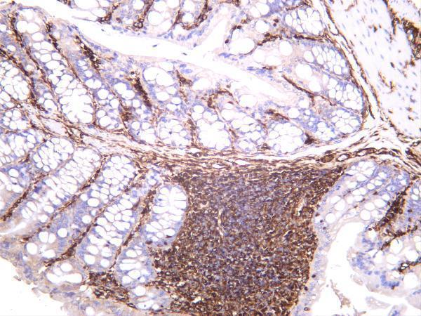 Mouse colon was stained with anti-Vimentin rabbit antibody