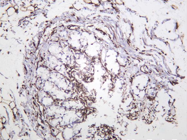 Rat colon was stained with anti-Vimentin rabbit antibody