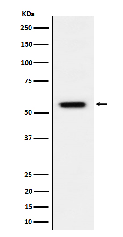Western blot analysis of Phospho-Vimentin (S39) expression in HeLa treated with Calyculin A cell lysate