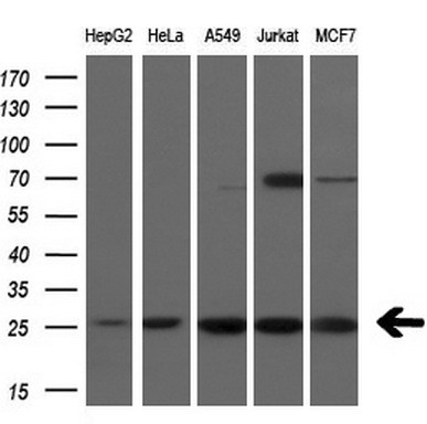 Western blot analysis of extracts (10ug) from 5 different cell lines by using anti-FADD monoclonal antibody at 1:200 dilution