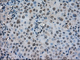 m00238 1 anti superoxide dismutase 1 sod1 mouse monoclonal antibody clone id oti8b10 ihc testing 5