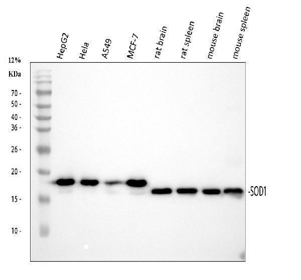  Western blot analysis of SOD1 using anti-SOD1 antibody (M00238-1)