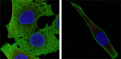Confocal immunofluorescence analysis of PANC-1 (left) and SKBR-3 (right) cells using SOD-1 Monoclonal Antibody (green)