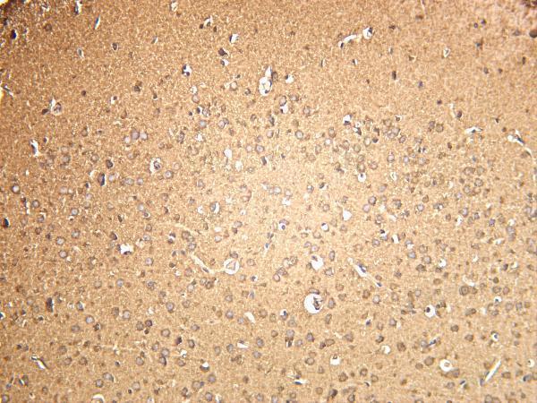 Mouse brain was stained with anti-SOD1 rabbit antibody