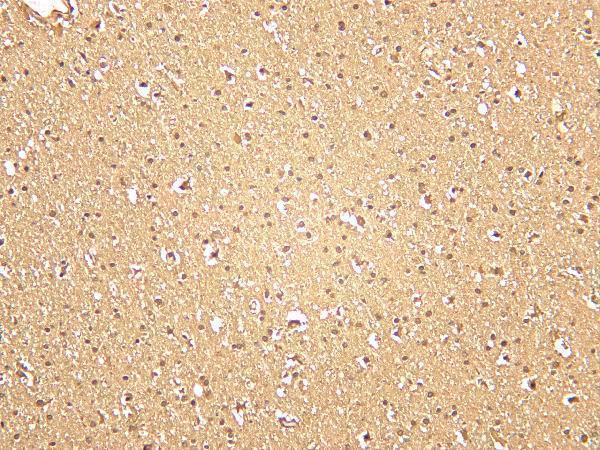 Human brain was stained with anti-SOD1 rabbit antibody