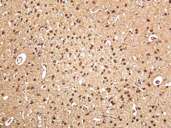 Rat brain was stained with anti-SOD1 rabbit antibody