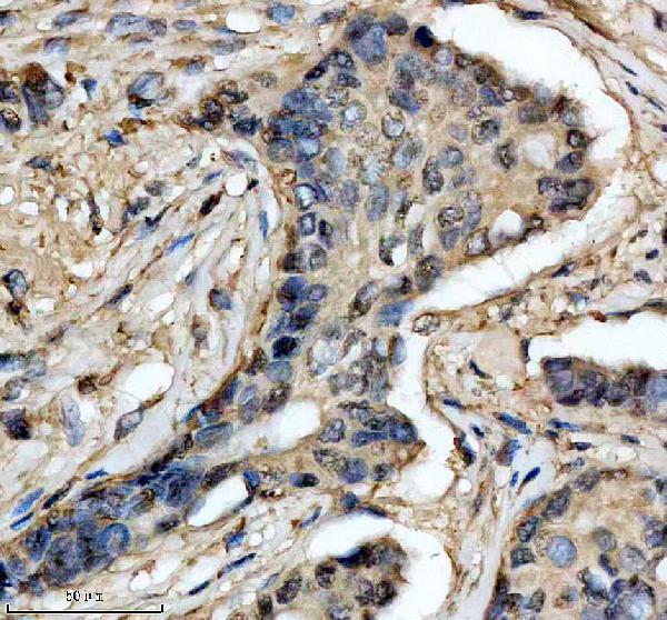 IHC analysis of SOD1 using anti-SOD1 antibody (M00238)