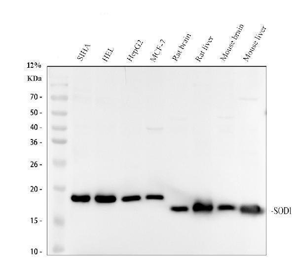 Western blot analysis of SOD1/Cu Zn Sod using anti-SOD1/Cu Zn Sod antibody (M00238)