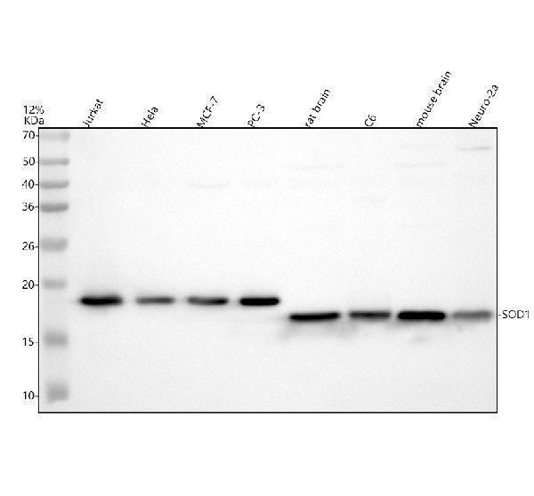 Western blot analysis of SOD1 using anti-SOD1 antibody (M00238)