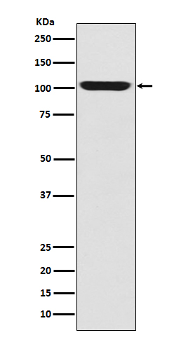 Western blot analysis of GPR49 expression in Human fetal skeletal muscle lysate