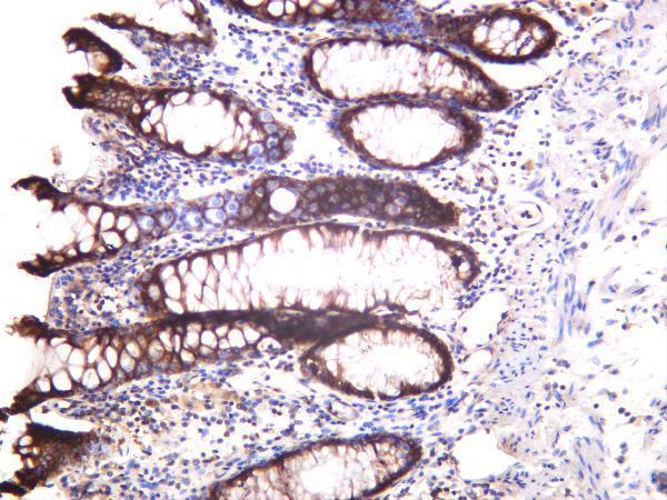 Human colon was stained with anti-ATG5 rabbit antibody