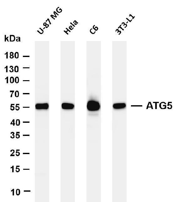 Various whole cell lysates were separated by 4-20% SDS-PAGE, and the membrane was blotted with anti-ATG5 antibody