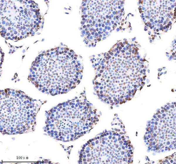 Figure 4. IHC analysis of H2AFX using anti-H2AFX antibody (M00241-1). H2AFX was detected in a paraffin-embedded section of mouse testis tissue. Heat mediated antigen retrieval was performed in EDTA buffer (pH 8.0, epitope retrieval solution). The tissue section was blocked with 10% goat serum. The tissue section was then incubated with 1:200 rabbit anti-H2AFX Antibody (M00241-1) overnight at 4°C. Peroxidase Conjugated Goat Anti-rabbit IgG was used as secondary antibody and incubated for 30 minutes at 37°C. The tissue section was developed using HRP Conjugated Rabbit IgG Super Vision Assay Kit (Catalog # SV0002) with DAB as the chromogen. Figure 4. IHC analysis of H2AFX using anti-H2AFX antibody (M00241-1). H2AFX was detected in a paraffin-embedded section of mouse testis tissue. Heat mediated antigen retrieval was performed in EDTA buffer (pH 8.0, epitope retrieval solution). The tissue section was blocked with 10% goat serum. The tissue section was then incubated with 1:200 rabbit anti-H2AFX Antibody (M00241-1) overnight at 4°C. Peroxidase Conjugated Goat Anti-rabbit IgG was used as secondary antibody and incubated for 30 minutes at 37°C. The tissue section was developed using HRP Conjugated Rabbit IgG Super Vision Assay Kit (Catalog # SV0002) with DAB as the chromogen.