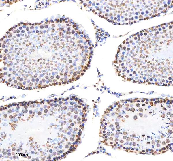 Figure 5. IHC analysis of H2AFX using anti-H2AFX antibody (M00241-1). H2AFX was detected in a paraffin-embedded section of rat testis tissue. Heat mediated antigen retrieval was performed in EDTA buffer (pH 8.0, epitope retrieval solution). The tissue section was blocked with 10% goat serum. The tissue section was then incubated with 1:200 rabbit anti-H2AFX Antibody (M00241-1) overnight at 4°C. Peroxidase Conjugated Goat Anti-rabbit IgG was used as secondary antibody and incubated for 30 minutes at 37°C. The tissue section was developed using HRP Conjugated Rabbit IgG Super Vision Assay Kit (Catalog # SV0002) with DAB as the chromogen. Figure 5. IHC analysis of H2AFX using anti-H2AFX antibody (M00241-1). H2AFX was detected in a paraffin-embedded section of rat testis tissue. Heat mediated antigen retrieval was performed in EDTA buffer (pH 8.0, epitope retrieval solution). The tissue section was blocked with 10% goat serum. The tissue section was then incubated with 1:200 rabbit anti-H2AFX Antibody (M00241-1) overnight at 4°C. Peroxidase Conjugated Goat Anti-rabbit IgG was used as secondary antibody and incubated for 30 minutes at 37°C. The tissue section was developed using HRP Conjugated Rabbit IgG Super Vision Assay Kit (Catalog # SV0002) with DAB as the chromogen.