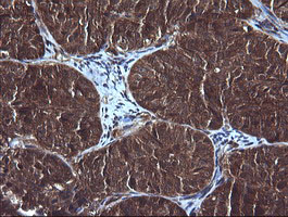 m00244 1 anti ddx58 mouse monoclonal antibody clone id oti6c1 ihc testing 4