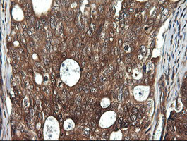 m00244 1 anti ddx58 mouse monoclonal antibody clone id oti6c1 ihc testing 6