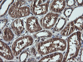 m00244 1 anti ddx58 mouse monoclonal antibody clone id oti6c1 ihc testing 7