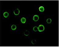 Immunofluorescent staining data of BTK using Anti-Tyrosine-protein kinase BTK Btk Monoclonal Antibody (M00245-1)