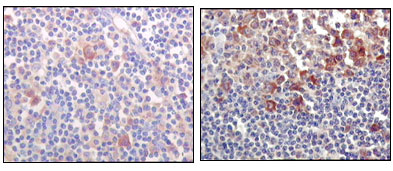 Immunohistochemistry validation of BTK using Anti-Tyrosine-protein kinase BTK Btk Monoclonal Antibody (M00245-1)