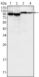 Western blotting validation for Anti-Tyrosine-protein kinase BTK Btk Monoclonal Antibody M00245-1
Western Blot (WB) analysis using Btk Monoclonal Antibody against K562 (1)