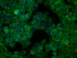 m00245 2 anti btk mouse monoclonal antibody clone id oti3a2 if testing 10